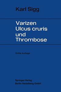 Varizen, Ulcus Cruris Und Thrombose