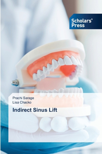 Indirect Sinus Lift