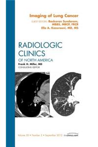 Imaging of Lung Cancer, an Issue of Radiologic Clinics of North America