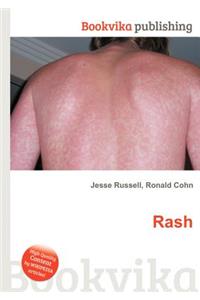 Rash