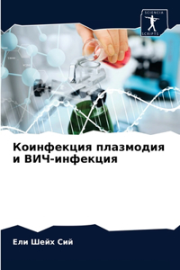 Коинфекция плазмодия и ВИЧ-инфекция