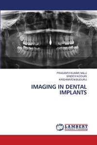 Imaging in Dental Implants