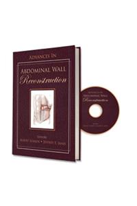 Advances in Abdominal Wall Reconstruction