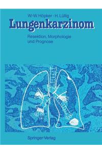 Lungenkarzinom