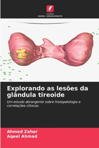 Explorando as lesões da glândula tireoide