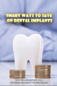 Smart Ways To Save On Dental Implants