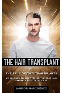 Hair Transplant