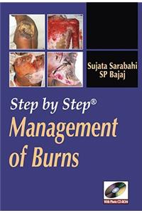 Step by Step Management of Burns