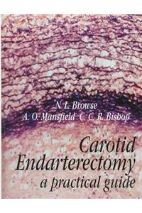 Carotid Endarterectomy: A Practical Guide