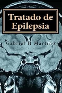 Tratado Epilepsia