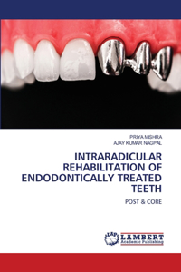 Intraradicular Rehabilitation of Endodontically Treated Teeth