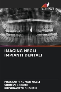 Imaging Negli Impianti Dentali