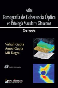 Atlas – Tomografía de Coherencia Óptica en Patología Macular y Glaucoma