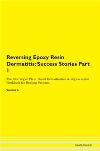 Reversing Epoxy Resin Dermatitis: Succes