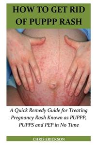 How to Get Rid of Puppp Rash