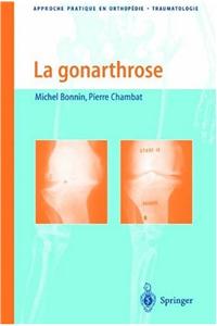 La Gonarthrose