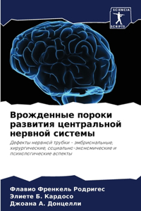 Врожденные пороки развития центральной н