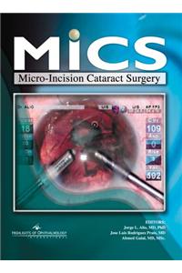 MICS Micro-Incision Cataract Surgery with CD-ROM
