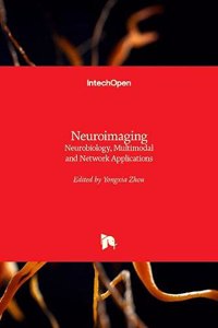 Neuroimaging