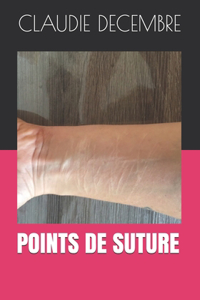 Points de suture