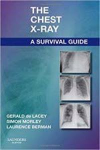 The Chest X - Ray A Survival Guide
