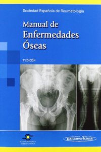 Manual De Enfermedades Oseas / Bone Diseases Manual