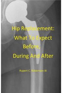 Hip Replacement: What To Expect Before, During and After
