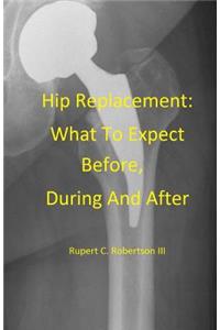 Hip Replacement