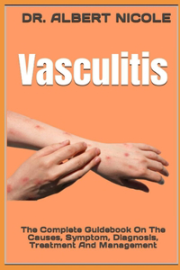 Vasculitis