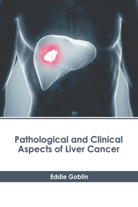 Pathological and Clinical Aspects of Liver Cancer