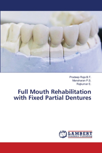 Full Mouth Rehabilitation with Fixed Partial Dentures