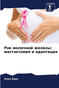 Рак молочной железы