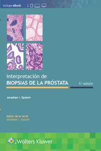 Interpretación de Biopsias de la Próstata