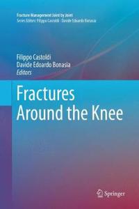 Fractures Around the Knee