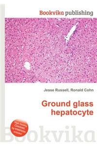 Ground Glass Hepatocyte