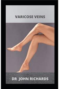 Varicose Veins