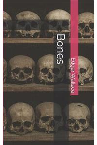 Bones
