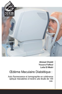 OEdème Maculaire Diabétique