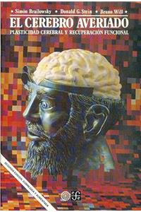 El Cerebro Averiado