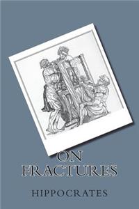On Fractures
