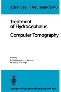 TREATMENT OF HYDROCEPHALUS COMPUTER TOM