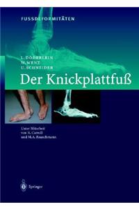 Fussdeformitaten