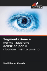 Segmentazione e normalizzazione dell'iride per il riconoscimento umano