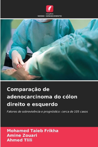 Comparação de adenocarcinoma do cólon direito e esquerdo