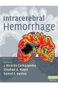 Intracerebral Hemorrhage