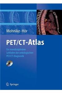 Pet/CT-Atlas: Ein Interdisziplinarer Leitfaden Der Onkologischen Pet/CT-Diagnostik
