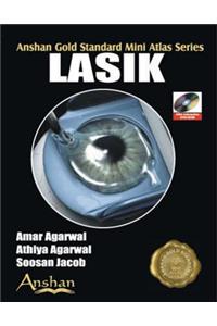 Mini Atlas of Lasik Surgery