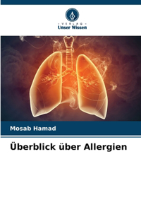 Überblick über Allergien