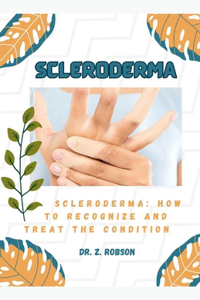 Scleroderma