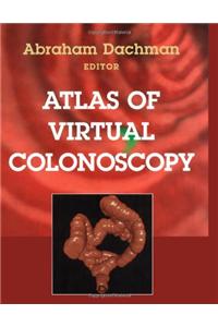 Atlas of Virtual Colonoscopy